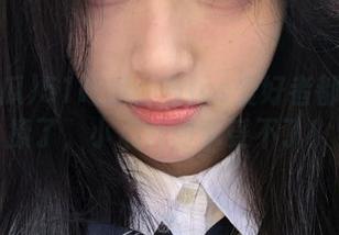 First Image