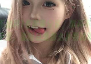 First Image